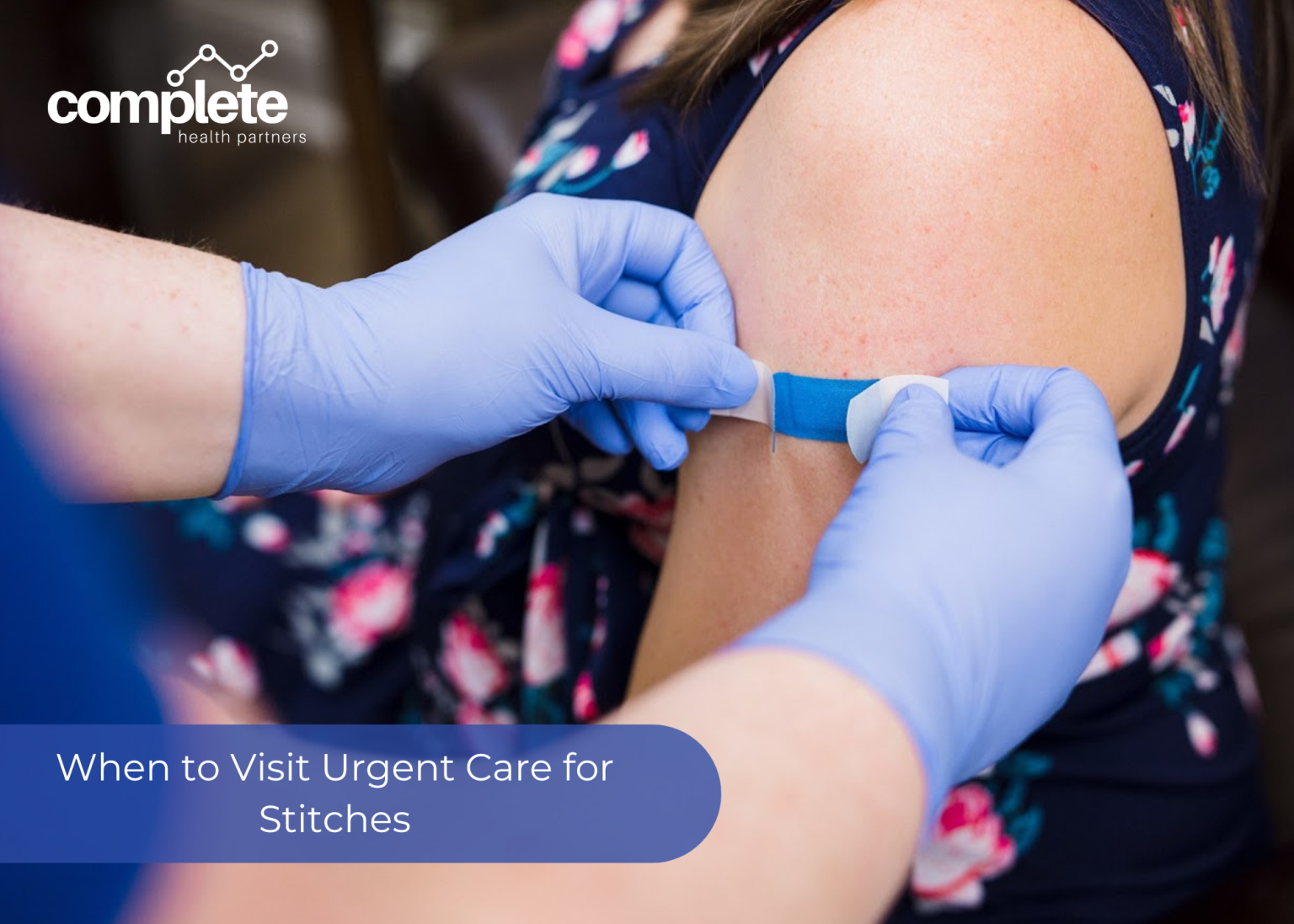 When To Visit Urgent Care For Stitches Complete Health Partners