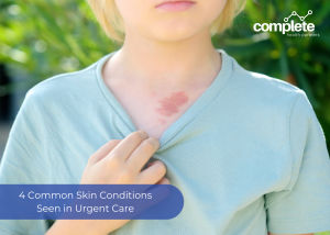 Skin Conditions Urgent Care